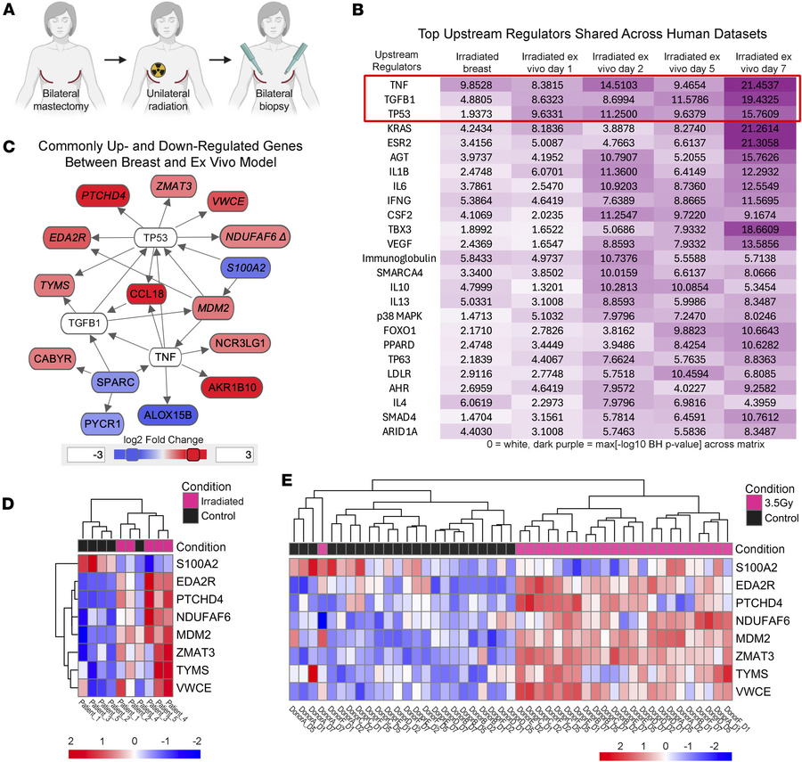 Correlation of ex vivo human skin radiation response with irradiated bre...