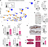 Induction of EMT and profibrotic genes in irradiated ex vivo skin.