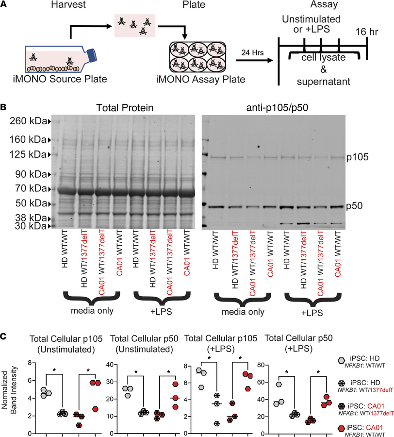 Heterozygous NFKB1 1377delT variant is necessary and sufficient to cause...