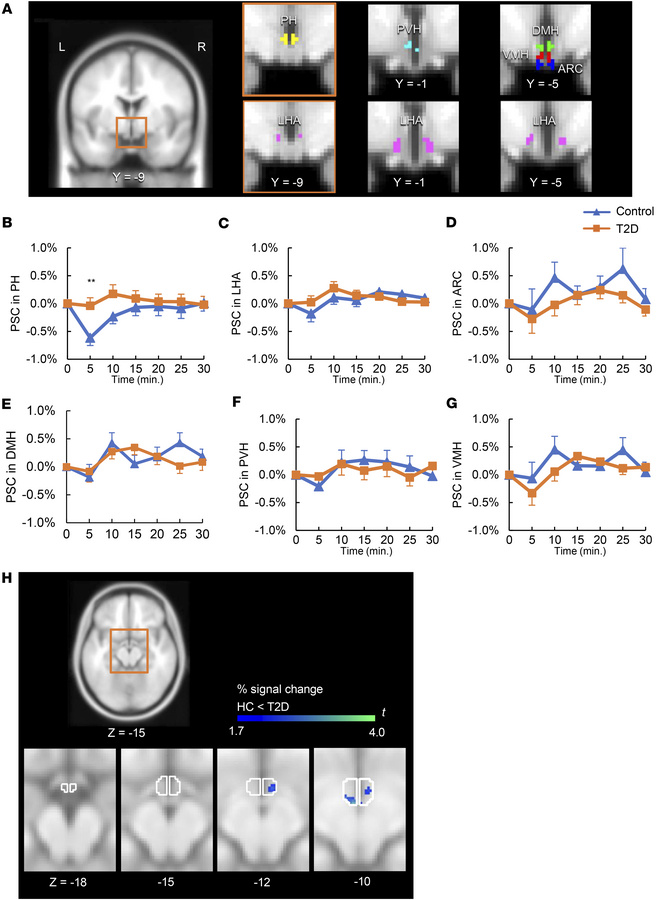 Time courses of hypothalamic BOLD signals following intranasal insulin a...