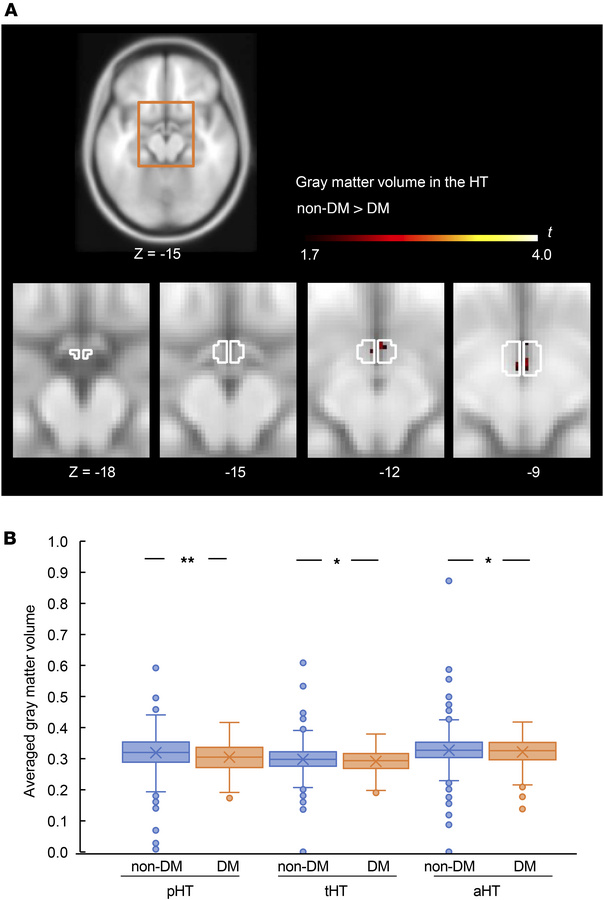Hypothalamic gray matter volume in the Bunkyo Health Study cohort (study...