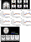 Time courses of hypothalamic BOLD signals following intranasal insulin admi
