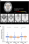 Hypothalamic gray matter volume in the Bunkyo Health Study cohort (study 2)