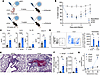 Early-life viral infection leads to skewed secondary response recapitulatin