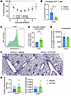 Lung-resident cells are sufficient to cause asthma-like pathology after ear