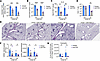 Local depletion of CD4+ T cells partially mitigates asthma pathology.