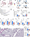 Early JAK2 inhibition reduces asthma pathology.