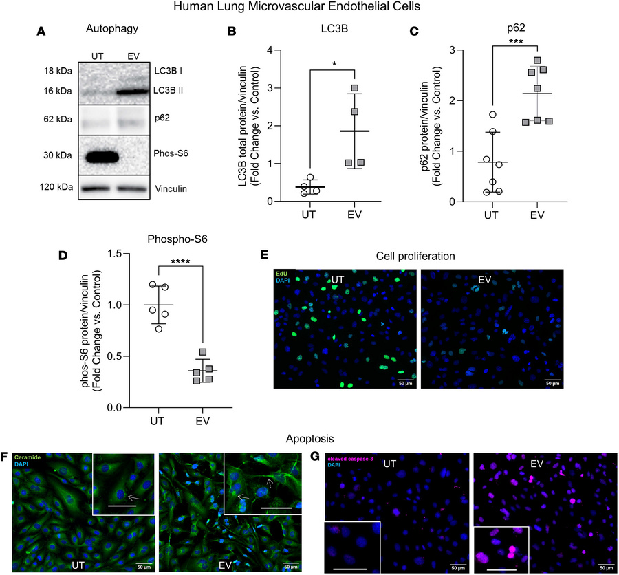 Effect of EV exposure on HLMVEC autophagy.
(A) Representative Western bl...