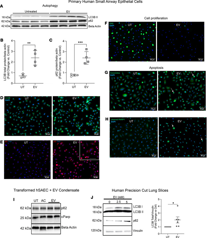 Effect of EV exposure on human lung small airway epithelial cell autopha...