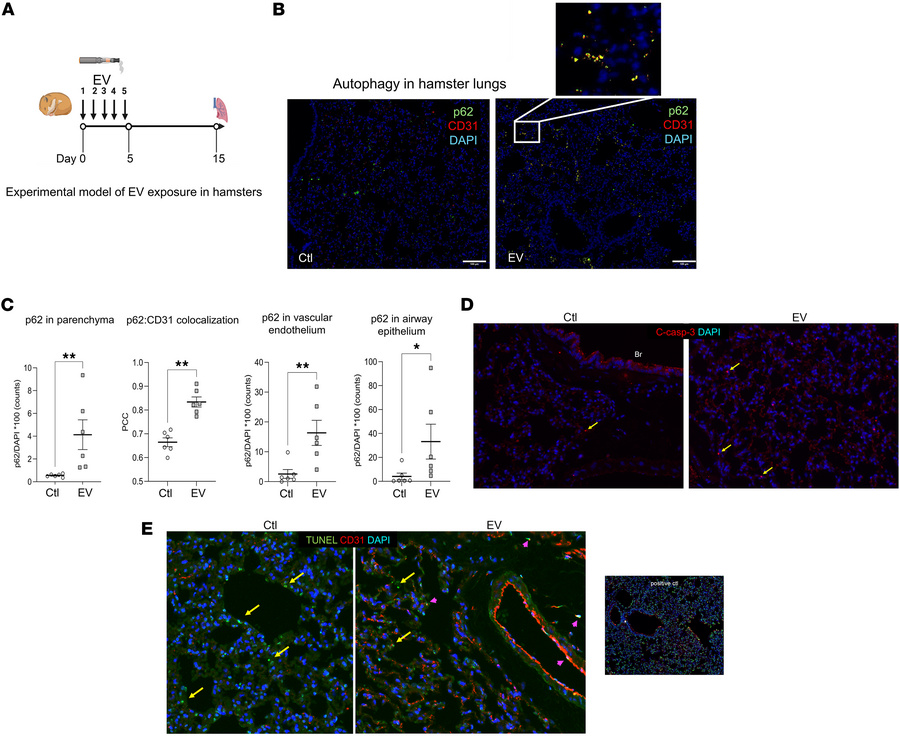 Persistent effects of brief EV exposure on distal lung autophagy in gold...