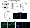 Effect of EV exposure on HLMVEC autophagy.