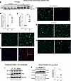 Effect of EV exposure on human lung small airway epithelial cell autophagy.