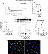 Role of JNK in EV-induced human lung microvascular endothelial autophagy.