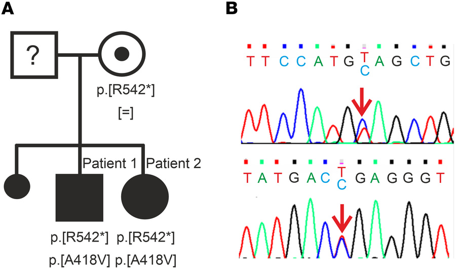 Patients’ pedigree and genotype.
(A) Patients’ pedigree. Shown are the k...