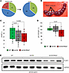 Variant FLAD1R542*/R542* is lethal, FLAD1A418V/R542* has a severe phenotype