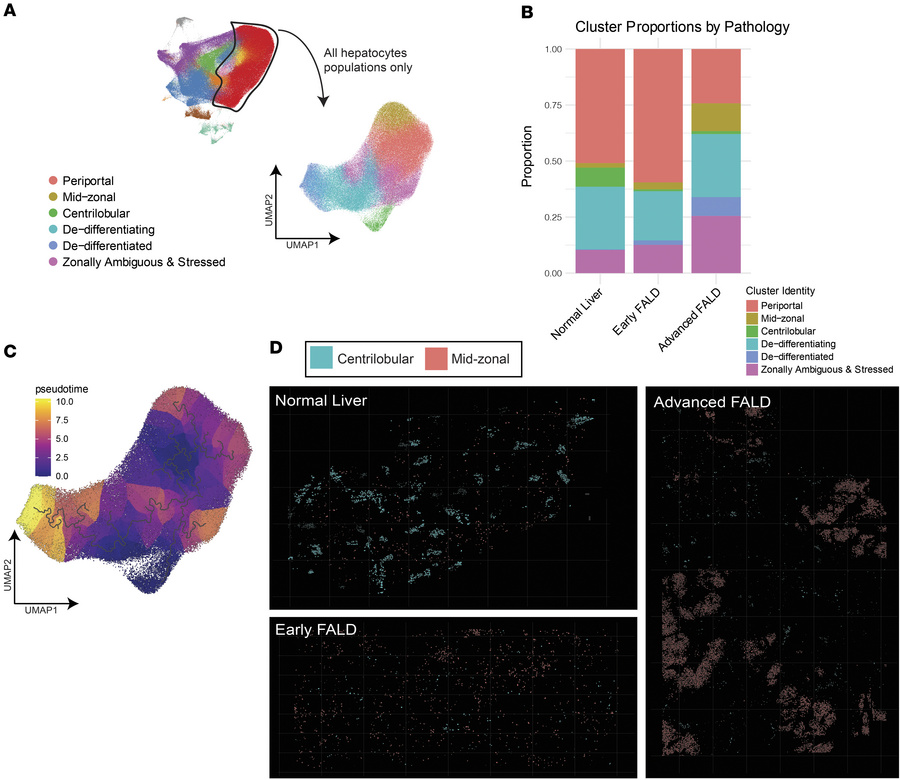 Liver hepatocyte zonation is disrupted in FALD.
(A) Uniform manifold app...