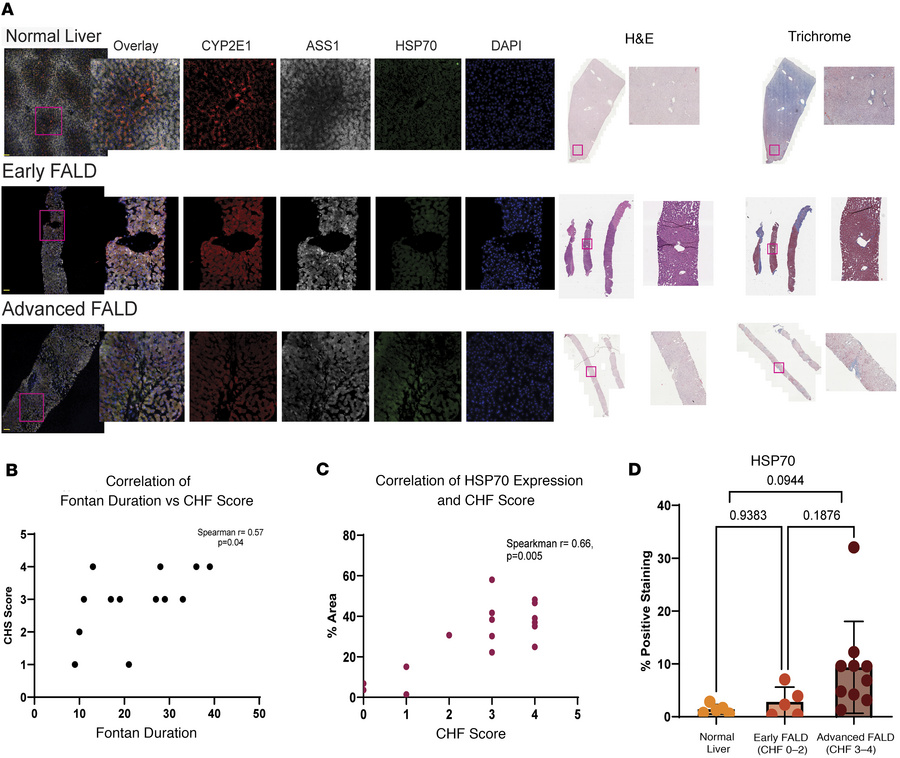Immunofluorescence of hepatocyte zonation markers and HSP70 demonstrates...