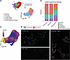 Liver hepatocyte zonation is disrupted in FALD.