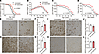 In vivo analysis of hit compounds in SOD1G93A transgenic mice.