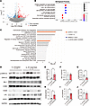 RNA-Seq analysis of the spinal cords from SOD1G93A transgenic mice treated