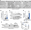 PI3Kγ MP increases the plasma membrane density of F508del-CFTR in combinati