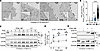 PI3Kγ MP does not affect F508del-CFTR maturation.