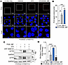 PKD1 activation by PI3Kγ MP enhances F508del-CFTR membrane localization.
