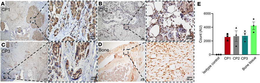 Immunohistochemistry showed expression of TRANCE in pediatric chronic pa...