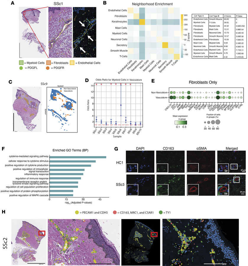 Single-cell spatial analysis demonstrates distinct, cytokine-rich neighb...