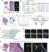 Single-cell spatial analysis demonstrates distinct, cytokine-rich neighborh