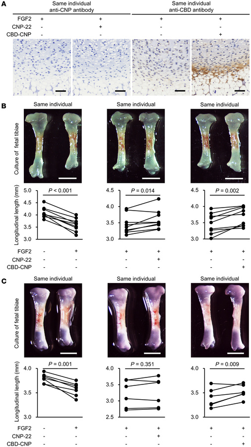 Bone growth effect of CBD-CNP in ex vivo bone culture.
(A) Representativ...