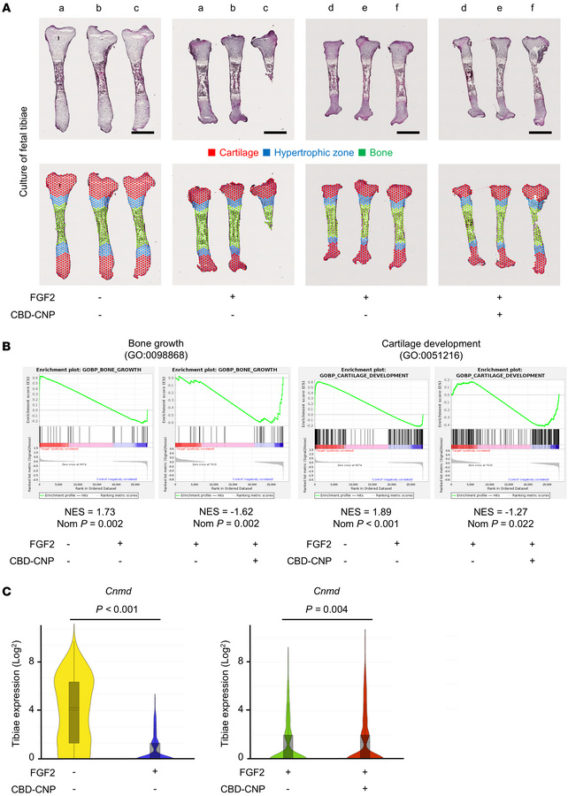 Pharmacological effects of CBD-CNP on bone growth revealed with spatial ...