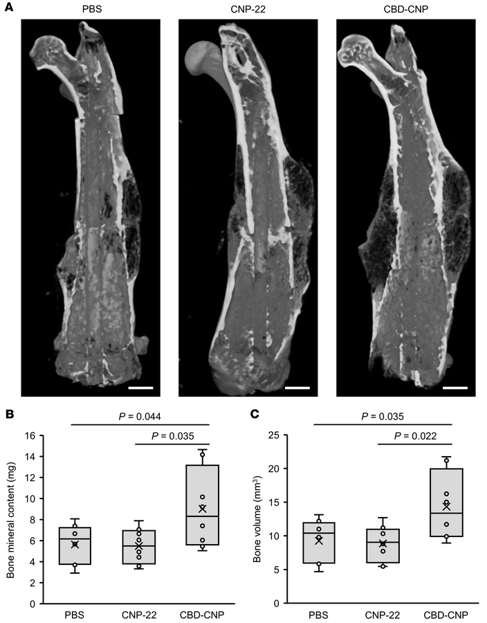 CBD-CNP increases bone volume in the C57BL/6J mouse model of bone fractu...