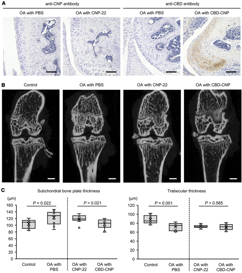 Intraarticular injection of CBD-CNP in the FVB/NJcl mouse model of knee ...