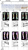Bone growth effect of CBD-CNP in ex vivo bone culture.
