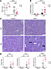 Kidney function and histopathological evaluation of VEGFR-3–specific RelA-d