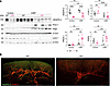 Lymphatic protein expression profiles in VEGFR-3–specific RelA-deficient mi