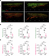 Visualization and quantification of lymphatic vessel features in VEGFR-3–sp