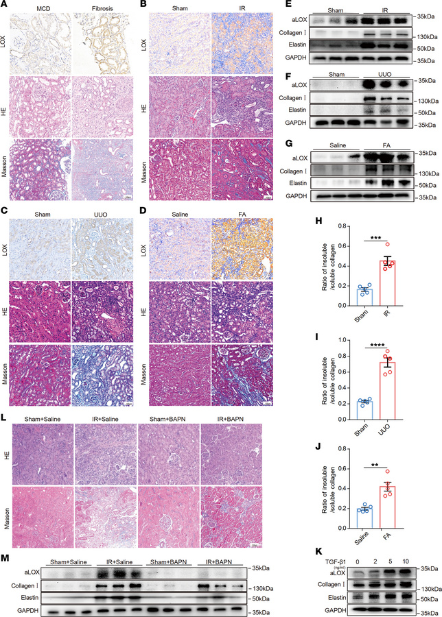 Expression of LOX and ECM cross-linking were markedly increased in fibro...
