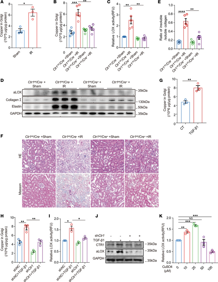 Reducing Golgi copper ion levels by downregulation of CTR1 decreases LOX...