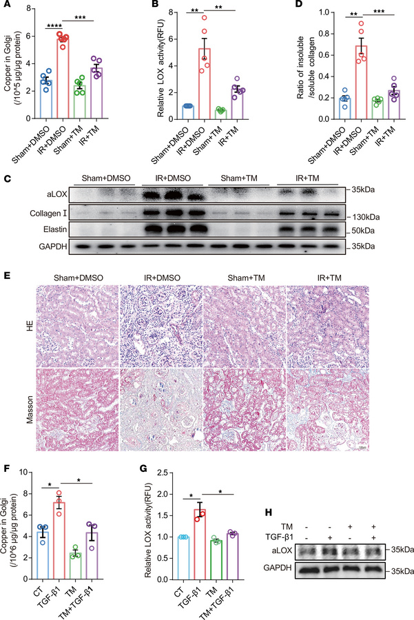 Reducing copper in Golgi apparatus with Cu chelators mitigated renal fib...