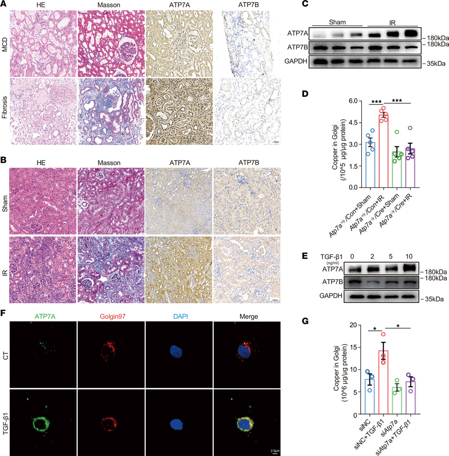 ATP7A mediates the increase of Golgi copper level in renal fibrosis.
(A)...