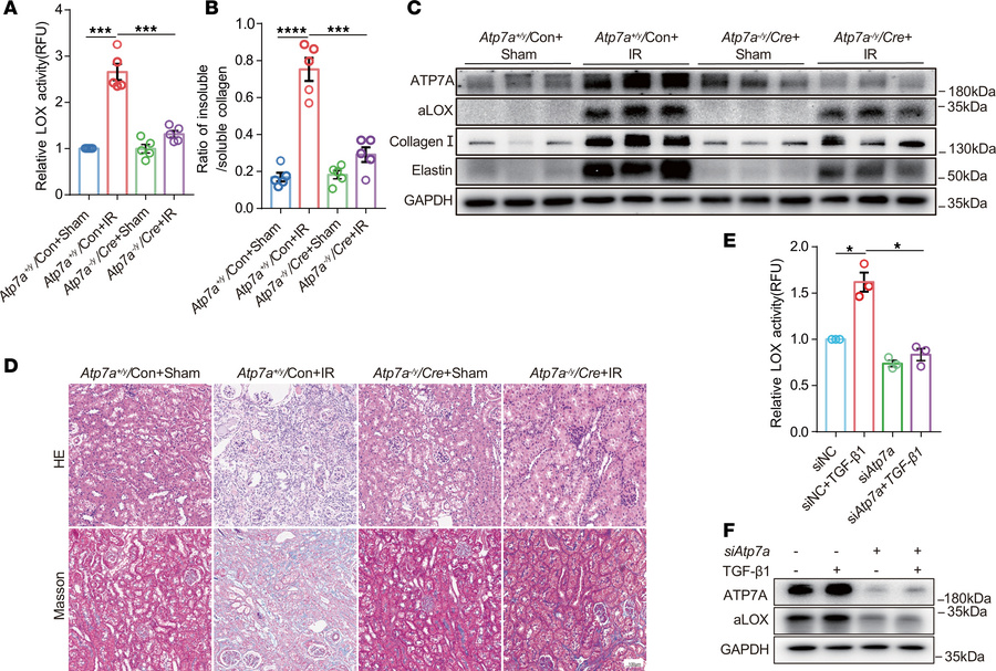 Downregulation of ATP7A in renal fibrosis reduces copper-dependent LOX a...
