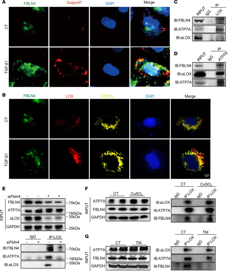 FBLN4 is essential for the formation of the ATP7A-LOX complex in renal f...