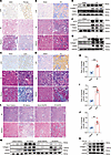 Expression of LOX and ECM cross-linking were markedly increased in fibrotic