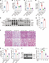 Reducing Golgi copper ion levels by downregulation of CTR1 decreases LOX ac