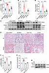 Reducing copper in Golgi apparatus with Cu chelators mitigated renal fibros
