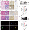 ATP7A mediates the increase of Golgi copper level in renal fibrosis.
