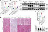 Downregulation of ATP7A in renal fibrosis reduces copper-dependent LOX acti