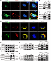 FBLN4 is essential for the formation of the ATP7A-LOX complex in renal fibr